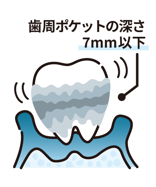 歯槽膿漏とは歯周病の末期状態のこと