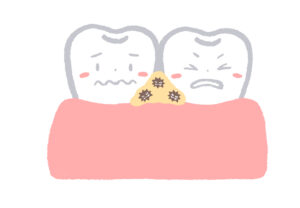 食べ物が歯に挟まる原因とは？